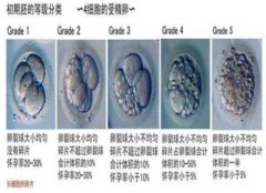 试管婴儿反复失败先要查清楚这几个原因