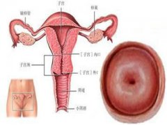 对子宫伤害最大的几件事情，你知道吗？