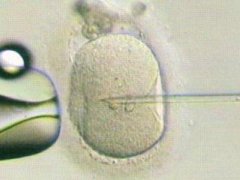 试管婴儿技术能解决卵巢早衰吗?